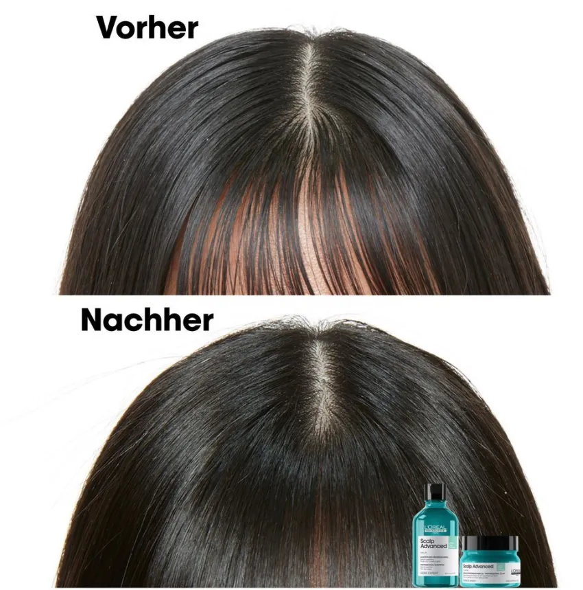 Hot L'Oréal Professionnel Paris L'Oréal Scalp Advanced Anti-Oiliness 2-in-1 Deep Purifier Clay
