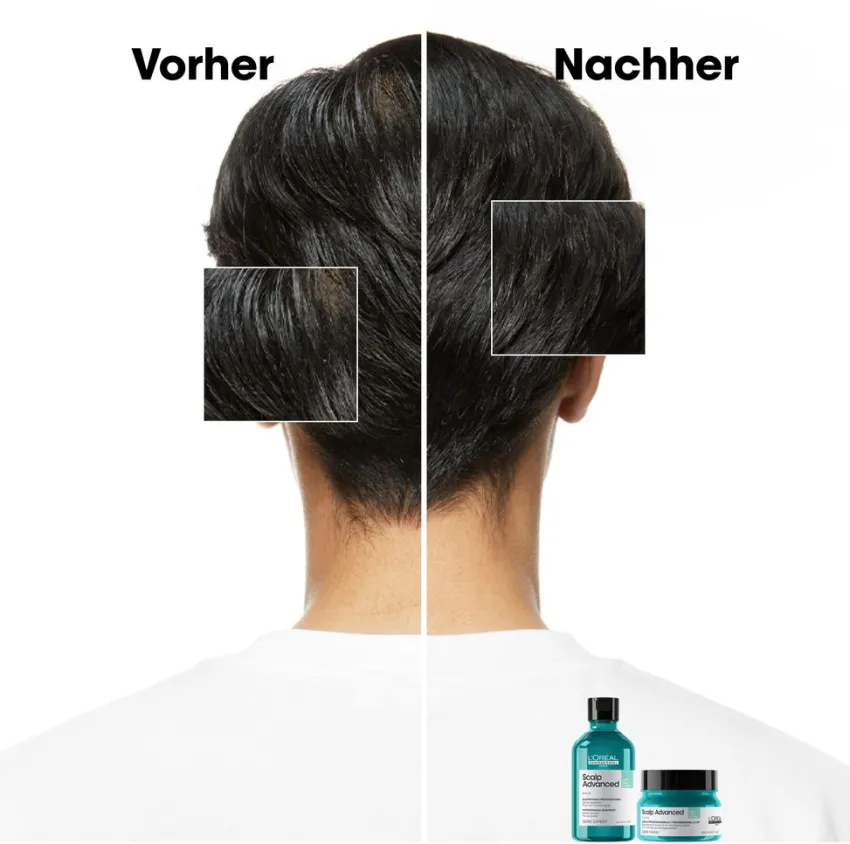 Hot L'Oréal Professionnel Paris L'Oréal Scalp Advanced Anti-Oiliness 2-in-1 Deep Purifier Clay