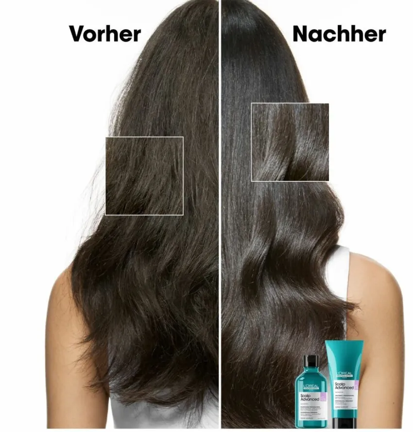 Fashion L'Oréal Professionnel Paris L'Oréal Série Expert Scalp Advanced Anti-Discomfort Dermo-Regulator Refill Shampoo 500ml