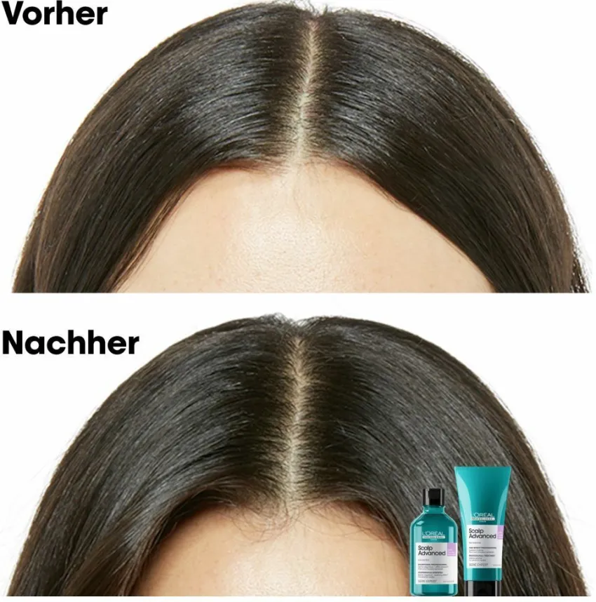 Fashion L'Oréal Professionnel Paris L'Oréal Série Expert Scalp Advanced Anti-Discomfort Dermo-Regulator Refill Shampoo 500ml
