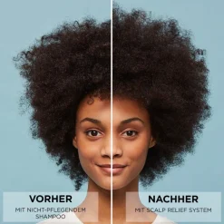 Hot Nioxin Scalp Relief 3-Stufen-System